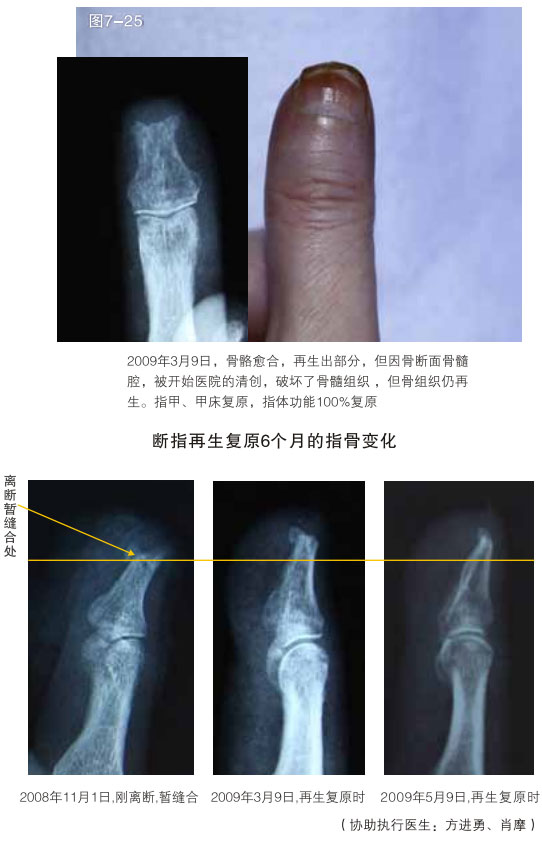 201121815824292