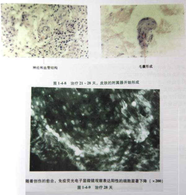 20113113440325