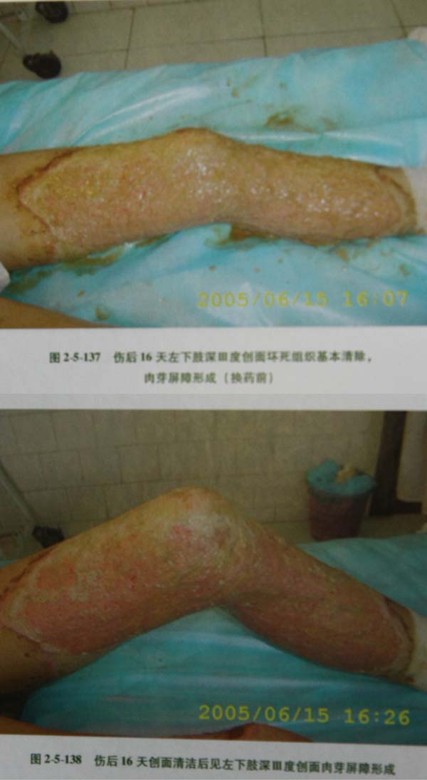 201131154159725